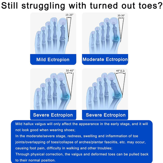 Correcteur d'oignon réglable